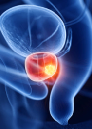 超40个月没有发生转移！达罗鲁胺给这类耐药肿瘤按下“暂停键”