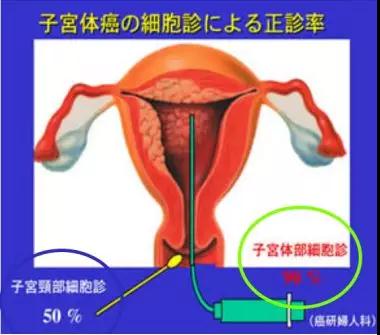 马云预言的“三大癌症将困扰每一个家庭”，是否已成现实？8.jpg