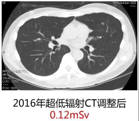 马云预言的“三大癌症将困扰每一个家庭”，是否已成现实？7.jpg