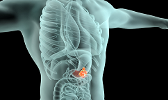 皇家马斯登医院：新研究发现了克服胃癌耐药性的新途径