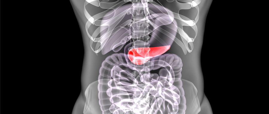 胰腺癌3.jpg 胰腺癌3.jpg