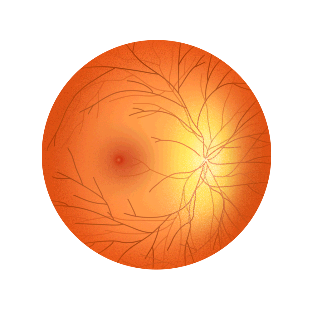视网膜的血管.png