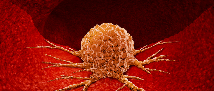 肿瘤癌症.jpg 肿瘤癌症.jpg