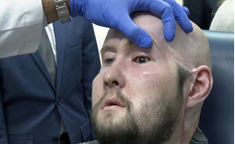 重大突破！美国医学团队成功进行全球首例全眼移植手术！