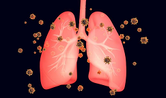 美国肺癌大咖：即便是晚期肺癌，若治疗得当，患者依然可能存活很多年！