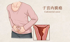 ​疾病稳定时长延长近2倍！晚期子宫内膜癌患者迎来有效联合疗法