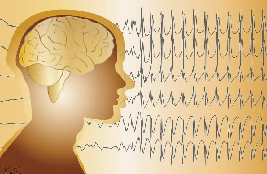 癫痫大发作