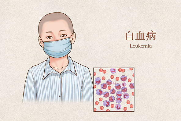 儿童白血病海外就医指南