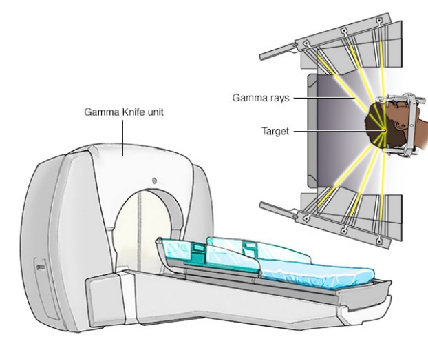 伽玛刀立体定向放射外科治疗设备