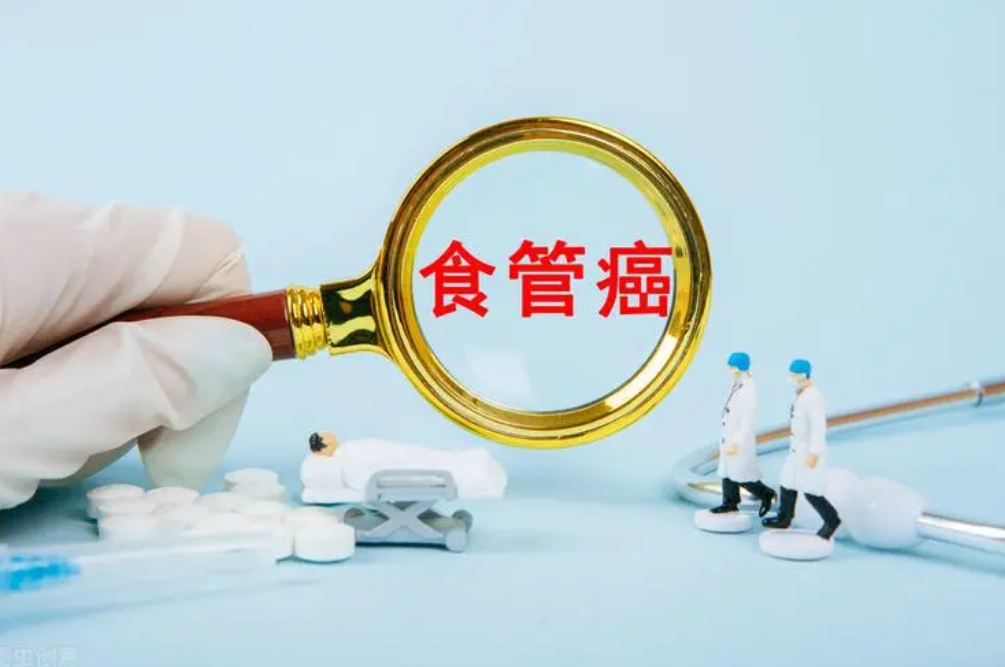 食管癌能治好吗？食管癌如何诊断？