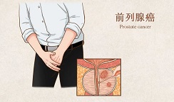 FDA批准前沿药Akeega治疗前列腺癌，显著改善患者生存期！