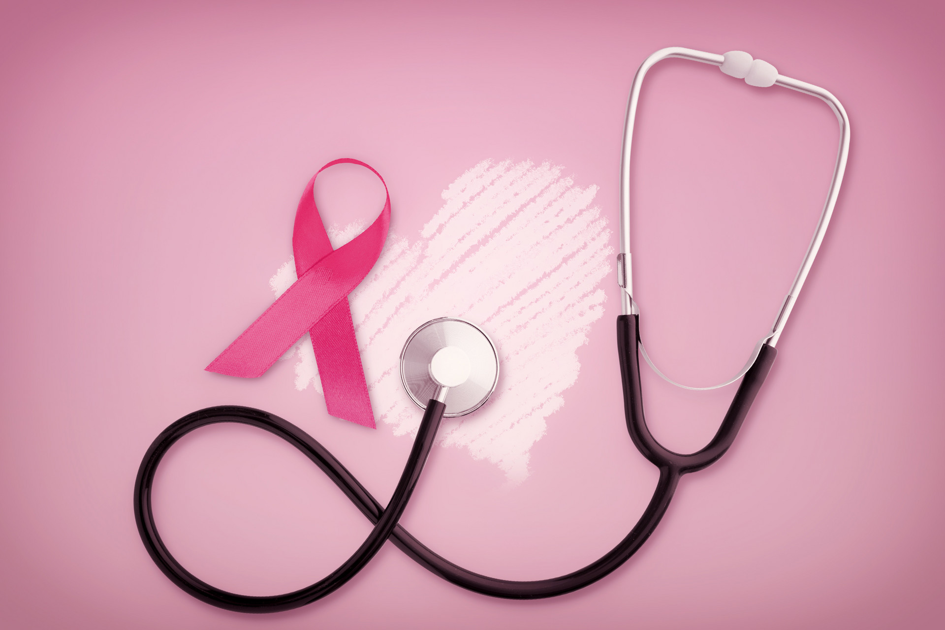 乳腺癌去美国治疗攻略：生存率、费用和医院推荐
