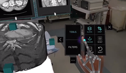 美国前沿AR（增强现实）技术，让手术医生多了双“透视眼”！