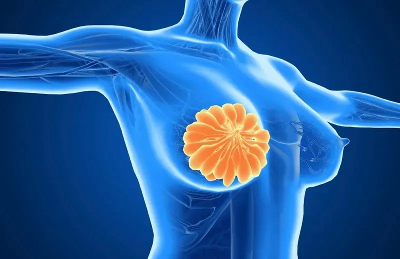 欧洲新研究:Ribociclib联合疗法用于乳腺癌术后辅助治疗,安全又有效! 欧洲新研究:Ribociclib联合疗法用于乳腺癌术后辅助治疗,安全又有效!