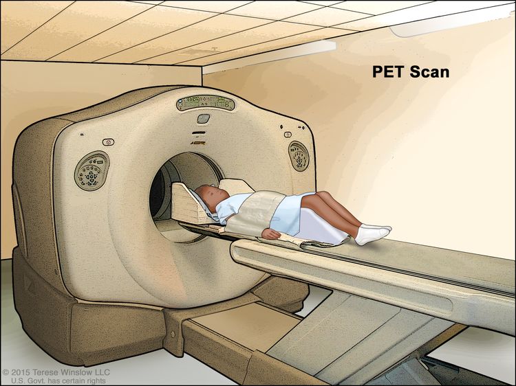 正电子发射断层扫描 (PET) ;图画显示一个孩子躺在桌子上,桌子滑过 PET 扫描仪。 正电子发射断层扫描 (PET) ;图画显示一个孩子躺在桌子上,桌子滑过 PET 扫描仪。
