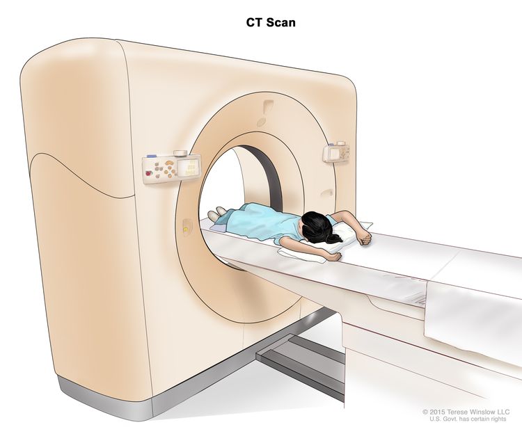 计算机断层扫描 (CT);图画显示一名儿童躺在一张桌子上,桌子滑过 CT 扫描仪,扫描仪会对其身体内部区域进行一系列详细的 X 射线照片。 计算机断层扫描 (CT);图画显示一名儿童躺在一张桌子上,桌子滑过 CT 扫描仪,扫描仪会对其身体内部区域进行一系列详细的 X 射线照片。