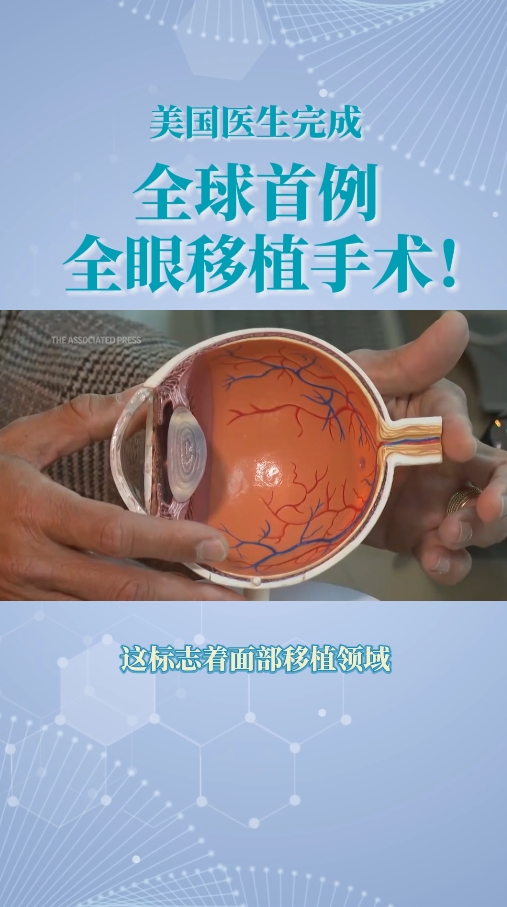 海外医疗新技术：美国医院完成全球首例全眼移植手术