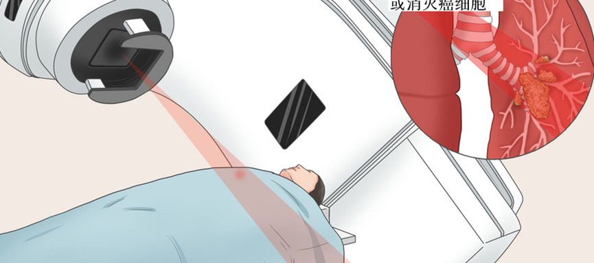 克利夫兰医学中心:放疗效果的关键竟是患者基因?如何实现低剂量、高疗效?