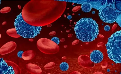 急性髓系白血病新药瑞维美尼(Revuforj)获批,打破复发AML患者“无药可用”困局