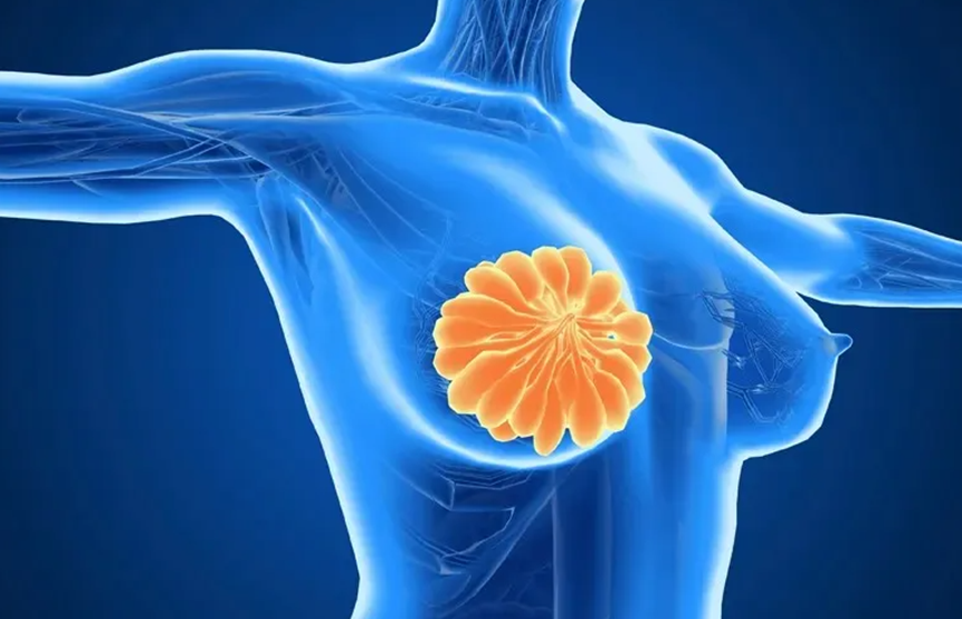 抽一管血，就能判断乳腺癌患者用不用手术、放化疗？美国科学家用“血液芯片”给答案！