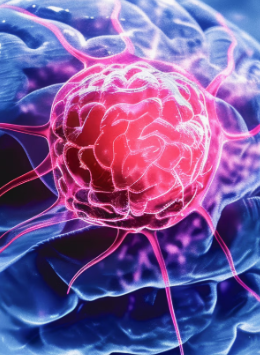 治愈了许多血癌患者的CAR-T疗法，正向脑癌发起攻势！近半患者肿瘤稳定或大幅缩小！