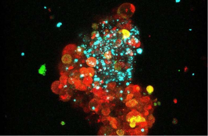 ER+乳腺癌患者福音!科学家发现,“扒掉”癌细胞的“隐身衣”,免疫治疗就可能变得有效!