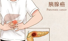 美国TAMP新疗法为晚期胰腺癌患者带来新希望：精准治疗，毒副作用更低！