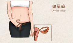 “去年一切正常”的她，竟查出晚期癌症？医生：八成患者将这种癌当成消化问题！