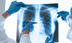 44%患者肿瘤显著缩小或消失！Adagrasib联合Pembrolizumab治疗KRAS G12C突变肺癌疗效显著