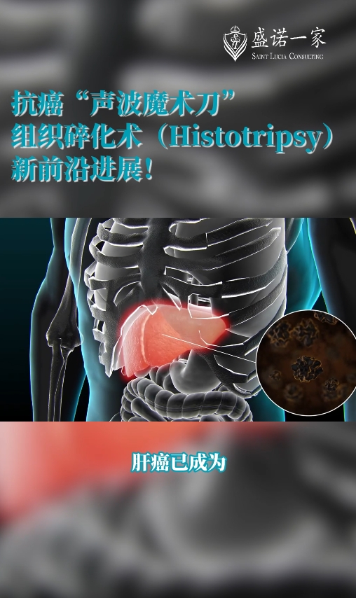 美国新药新技术：组织碎化技术新进展