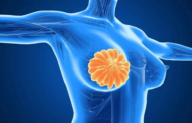 乳腺癌治疗新思路：片子正常，血液检出ESR1突变立即换药，疗效竟显著提升？