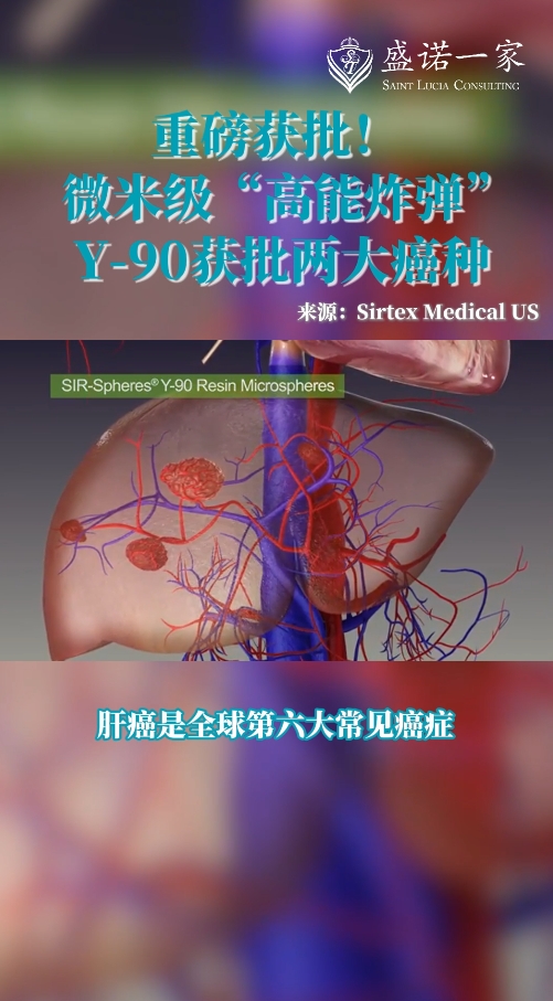 肝癌和结直肠癌肝转移患者的新希望：Y-90微球疗法在美国FDA获批