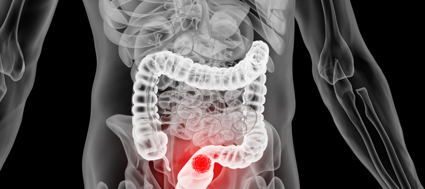 为什么手术、化疗等“全套治疗”都做了，癌症偏偏还是卷土重来？