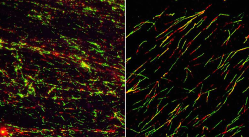 RP1基因异常患者迎来曙光：此类癌细胞“致命弱点”终于被找到，新疗法前景良好！