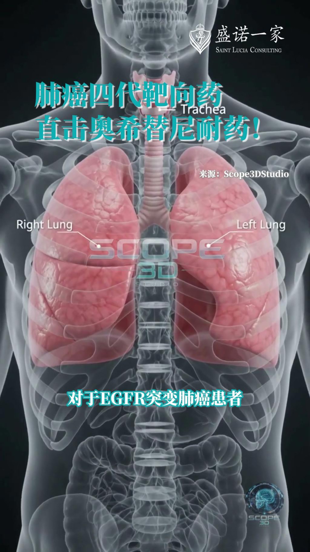 针对奥希替尼耐药，肺癌四代靶向药BH-30643 (SOLARA)使88%的患者病情得到控制