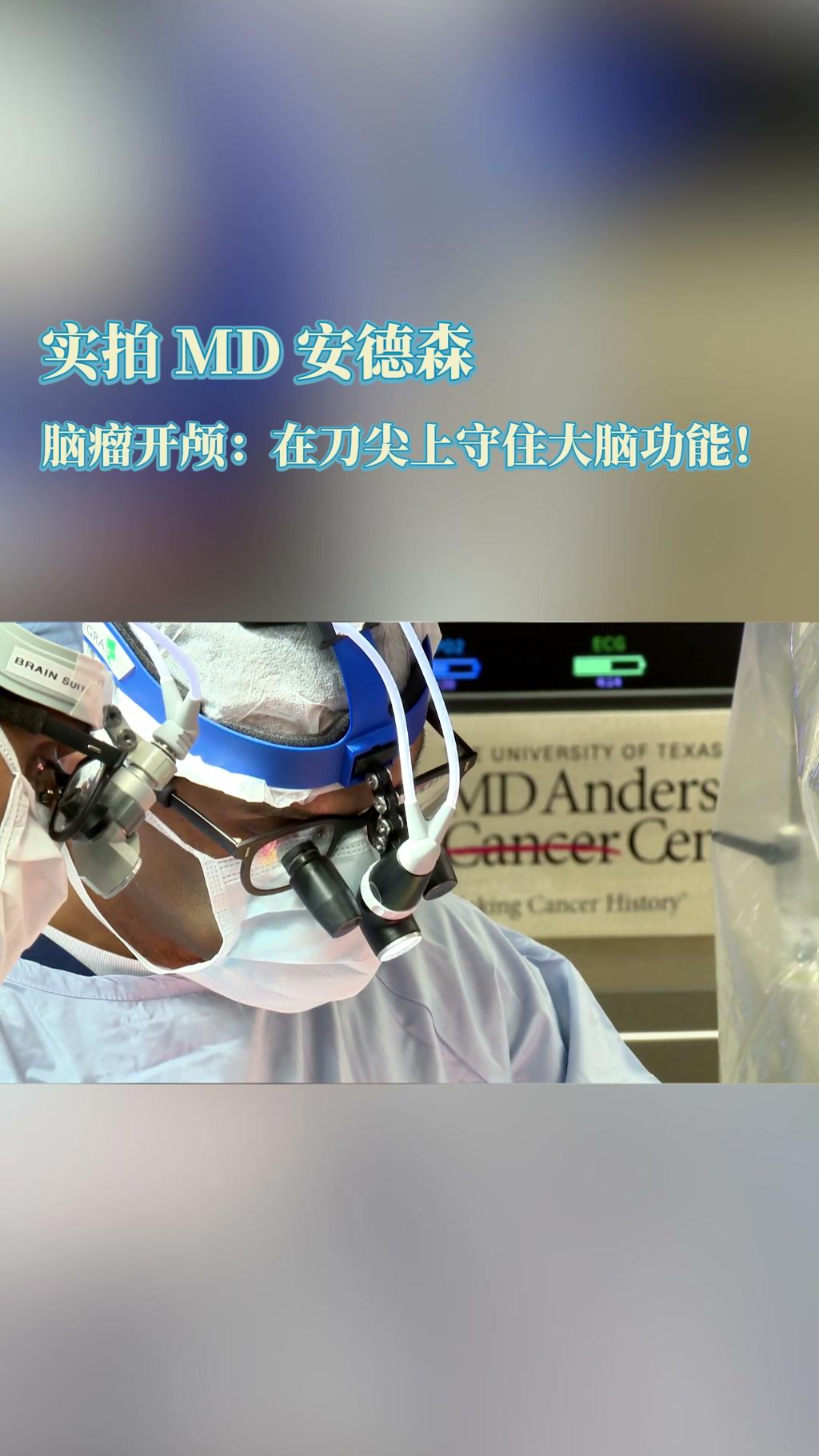 实拍MD安德森癌症中心脑瘤开颅：在刀尖上守住大脑功能
