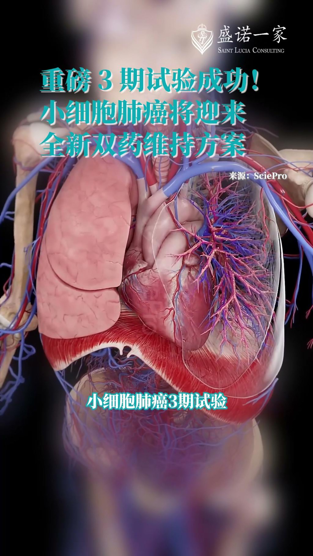 小细胞肺癌3期试验成功：度伐利尤单抗双药维持方案