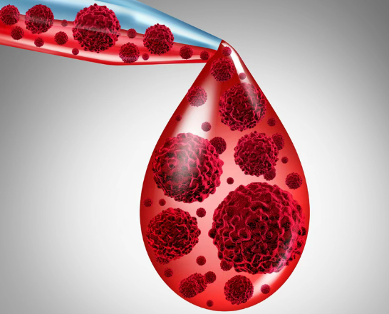 不用长期吃药了！美国批准慢性淋巴细胞白血病/小淋巴细胞淋巴瘤全新治疗方案