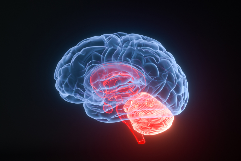 海外医疗前沿：靶向药Verzenio让非常难治的脑膜瘤患者病情稳住，半年无进展