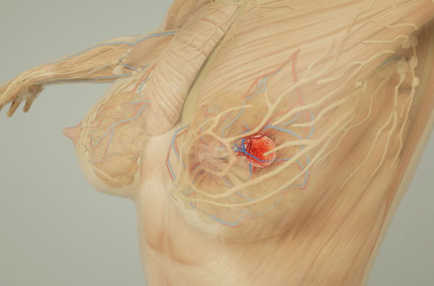 美国MD安德森癌症中心乳腺癌脑膜转移新突破：组合疗法显著延长患者生存期、有效缓解症状