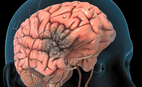 39岁女主播直播时突然头痛难忍，抢救11分钟后不幸离世…很多健康风险，其实早有信号