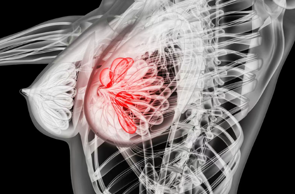 美国医学前沿：帮助乳腺癌患者避免二次手术！美国批准AI系统Claire上市