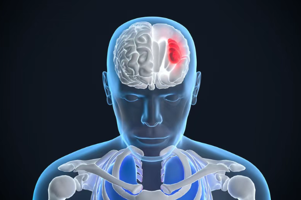 美国新药SRN-101获批启动1期临床试验，复发性高级别胶质瘤迎来新希望
