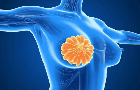 美国全新靶向药PMD-026开启临床试验，晚期和局部转移乳腺癌患者有望从中受益！