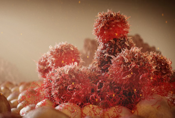 TP53突变有药了！口服靶向药Rezatapopt：44.4%难治性卵巢癌患者肿瘤大幅缩小或消失