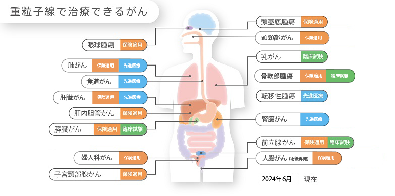 日本QST医院重离子疗法适应症