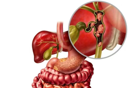 难治性胆道癌缓解率提升两倍多!美国FDA授予Tovecimig(CTX-009)孤儿药资格认定