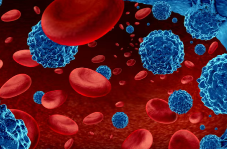 美国MD安德森癌症中心新研究：FLAG-GO组合药物方案，急性白血病67%患者5年无复发！