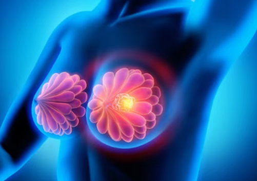 肿瘤控制时间翻3倍、死亡风险降67%！晚期乳腺癌新希望：AKT靶向药afuresertib离上市还远吗？