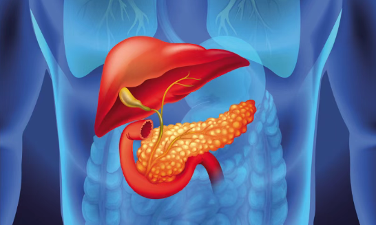 晚期胰腺癌新希望：美国新药BBO-11818获快速通道资格，覆盖绝大多数KRAS突变，一名患者肿瘤缩小56%！